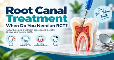 Root Canal Treatment: When Do You Need an RCT?